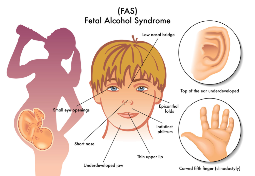 Fasd Neurofeedback And Integrated Therapy Institute