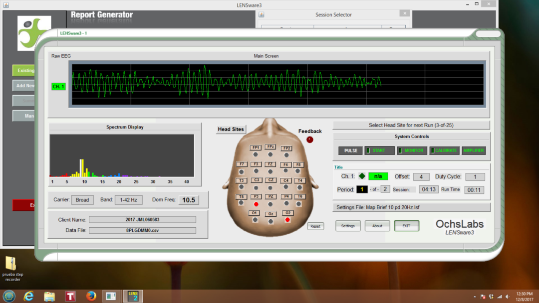 LENS (Low Energy Neurofeedback System) | Neurofeedback & Integrated ...